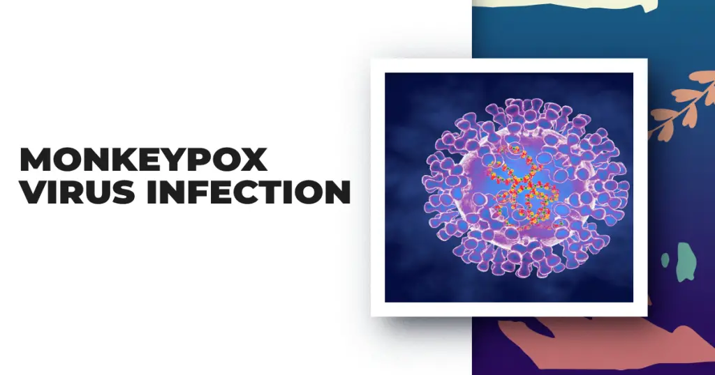 Monkeypox Virus Infection